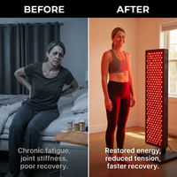 Red Light Therapy Panel Device – Full Body Panel, 630Nm 660Nm 810Nm 850Nm Red & near Infrared Light Therapy, 300 Quad Chip Leds, Brightness Control, Pulse Mode – ULTRA1500 — Before & After